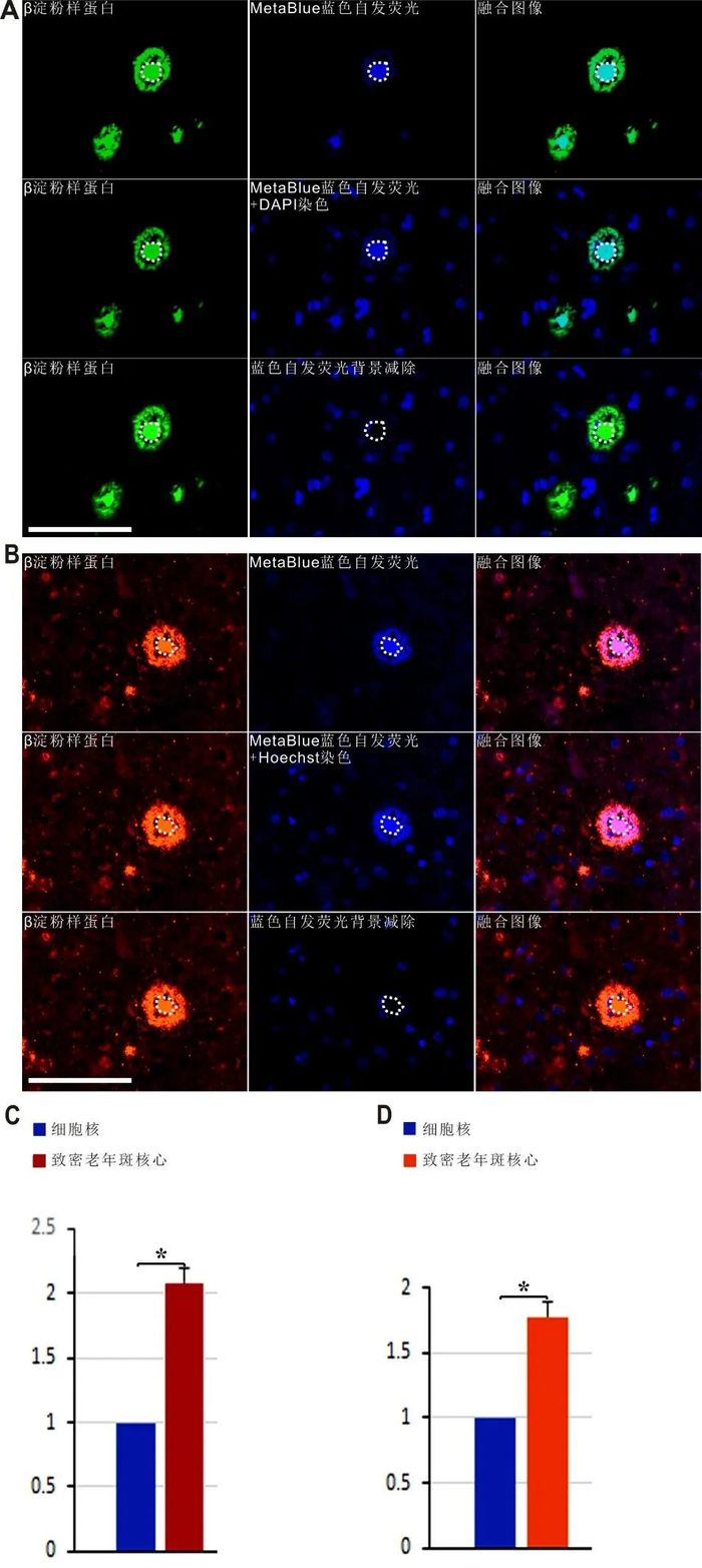 nb:上海交大付华林等报道阿尔兹海默症病理斑块的一