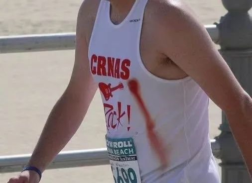 男人跑马拉松却"血流成河",乳头保卫战该何去何从?