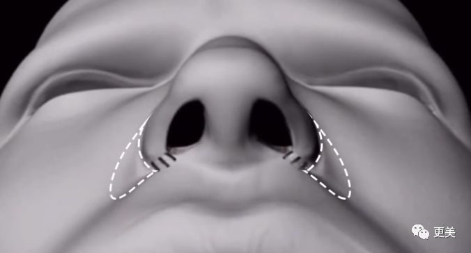 24岁女童星越大越漂亮多亏了新垫的鼻基底