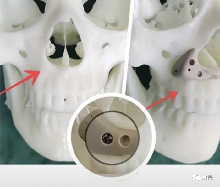 24岁女童星越大越漂亮多亏了新垫的鼻基底