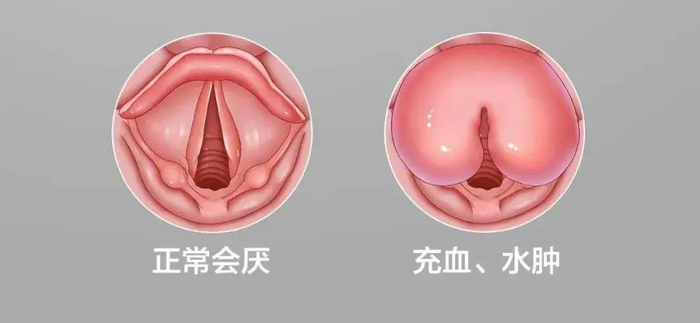 ▲图源：网络