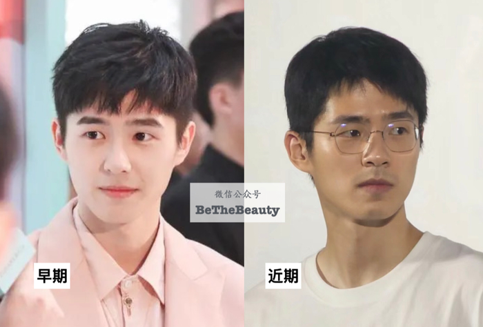 刘昊然皱纹松弛下垂都没有,按实际年龄算并不算老但主要是,感觉睁个