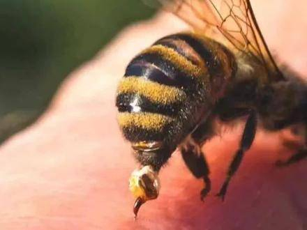蜜蜂蛰人后为什么会死掉