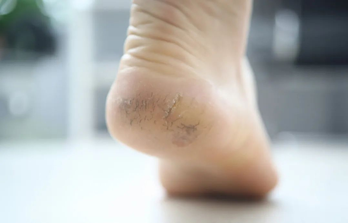 图库版权图片，转载使用可能引发版权纠纷