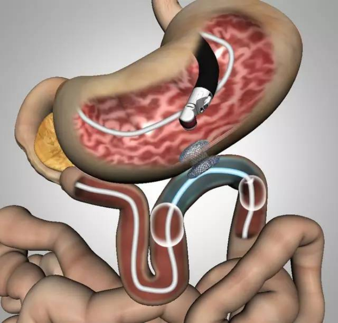 达到国内领先水平|中心医院|手术_新浪新闻