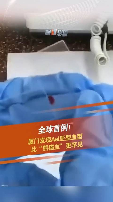 厦门发现全球首例稀有血型比熊猫血更罕见
