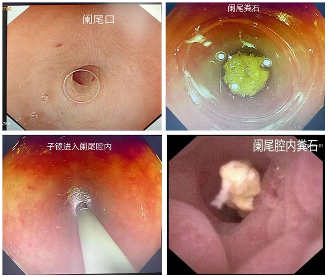 今日全宇宙最涨姿势的十张图|阑尾_新浪新闻