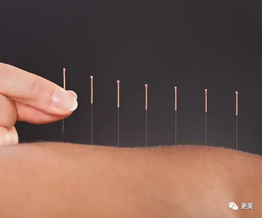 之前讲过微针的起源,其实就是从我们老祖宗的针灸皮刺疗法那里发展