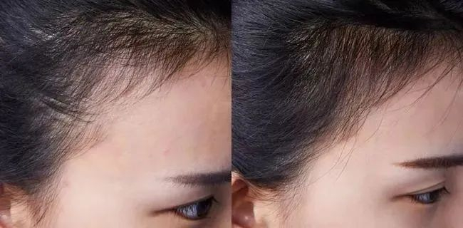 以黑养黑气色好熬夜党救星秃头姐妹1天1杯请速囤这杯五黑养生茶