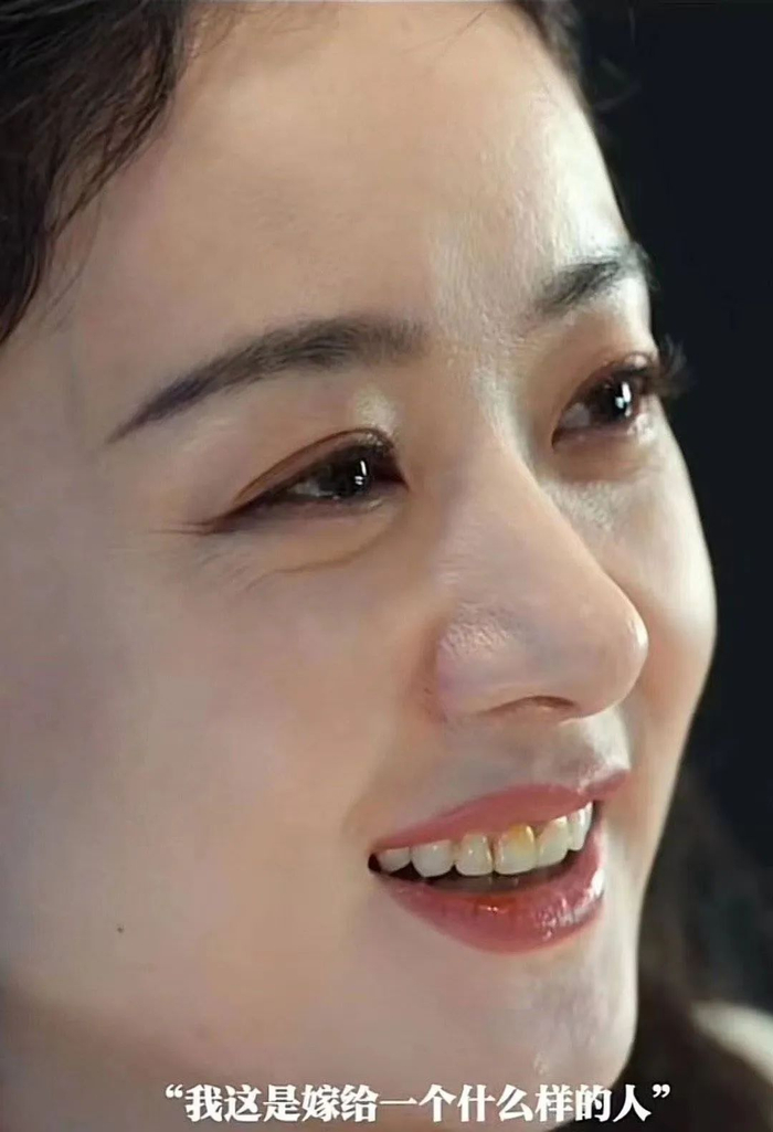 她主动曝出满脸皱纹.比如赵丽颖.