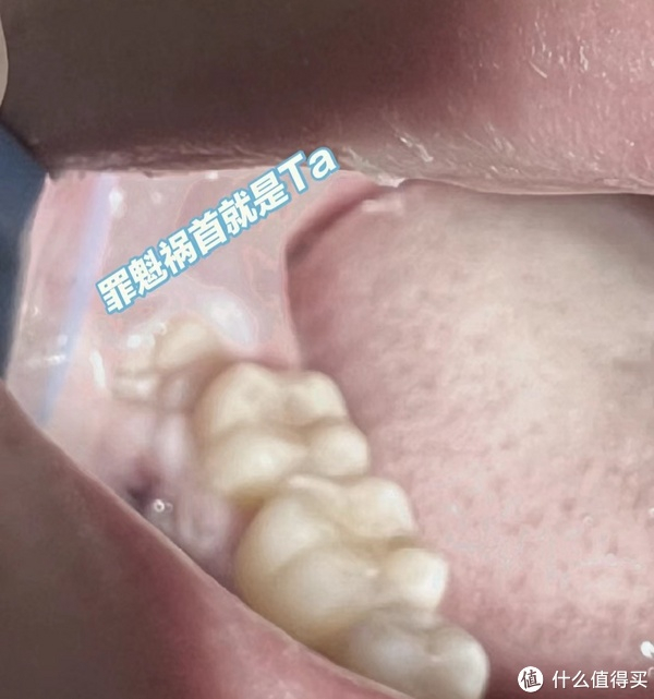 战胜恐惧最好的办法,就是面对恐惧,拔了智齿__财经头条