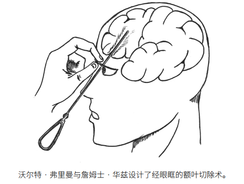脑科学真相谁在决定你的人格