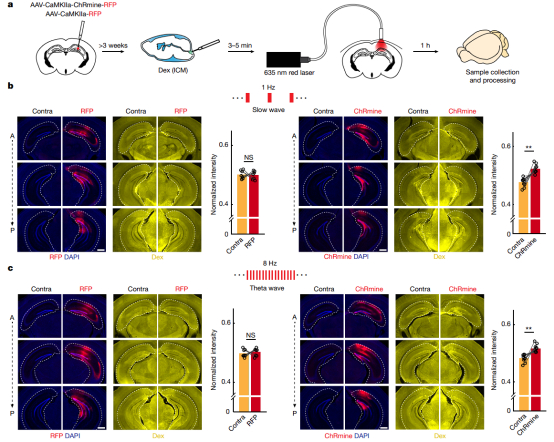 怎么清除麻醉Nature:大脑如何有效进行废物清理?最新发现神经元动力学介导脑脊液灌流和大脑清理的机制_新闻资讯_第5张_活检穿刺产品网 怎么清除麻醉Nature:大脑如何有效进行废物清理?最新发现神经元动力学介导脑脊液灌流和大脑清理的机制_https://www.jmylbn.com_新闻资讯_第5张