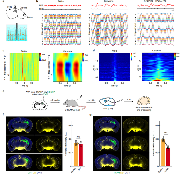 怎么清除麻醉Nature:大脑如何有效进行废物清理?最新发现神经元动力学介导脑脊液灌流和大脑清理的机制_新闻资讯_第2张_活检穿刺产品网 怎么清除麻醉Nature:大脑如何有效进行废物清理?最新发现神经元动力学介导脑脊液灌流和大脑清理的机制_https://www.jmylbn.com_新闻资讯_第2张