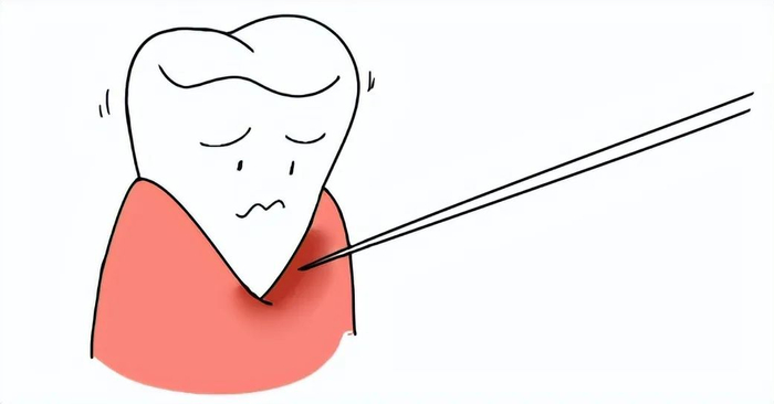 牙齿|疾病|牙签_新浪新闻