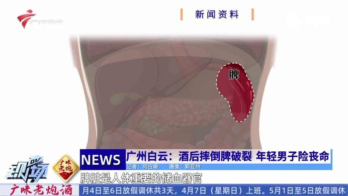 广州白云:酒后摔倒脾破裂 年轻男子险丧命