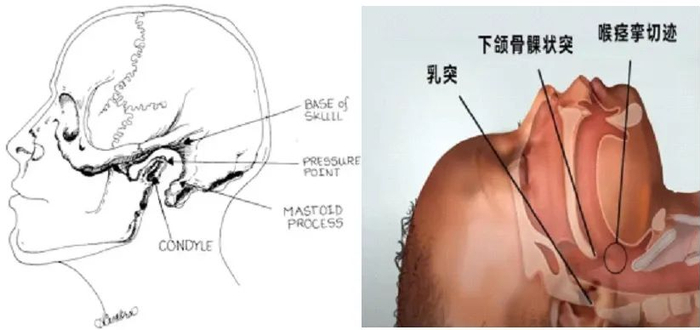 全麻面罩是什么无声的雪崩---一例全麻苏醒期患者发生喉痉挛的护理经验分享-上海聚慕医疗器械有限公司