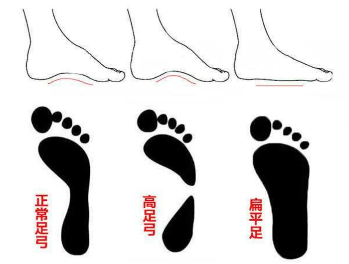 抢疯了亚瑟士热买专场来了全场都是捡漏价便宜还好穿