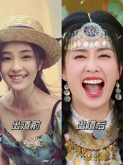 谢谢你,打消了我整牙的想法……|白鹿_新浪新闻