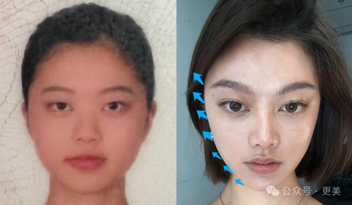 她光鼻子就整了3次!|网红_新浪新闻