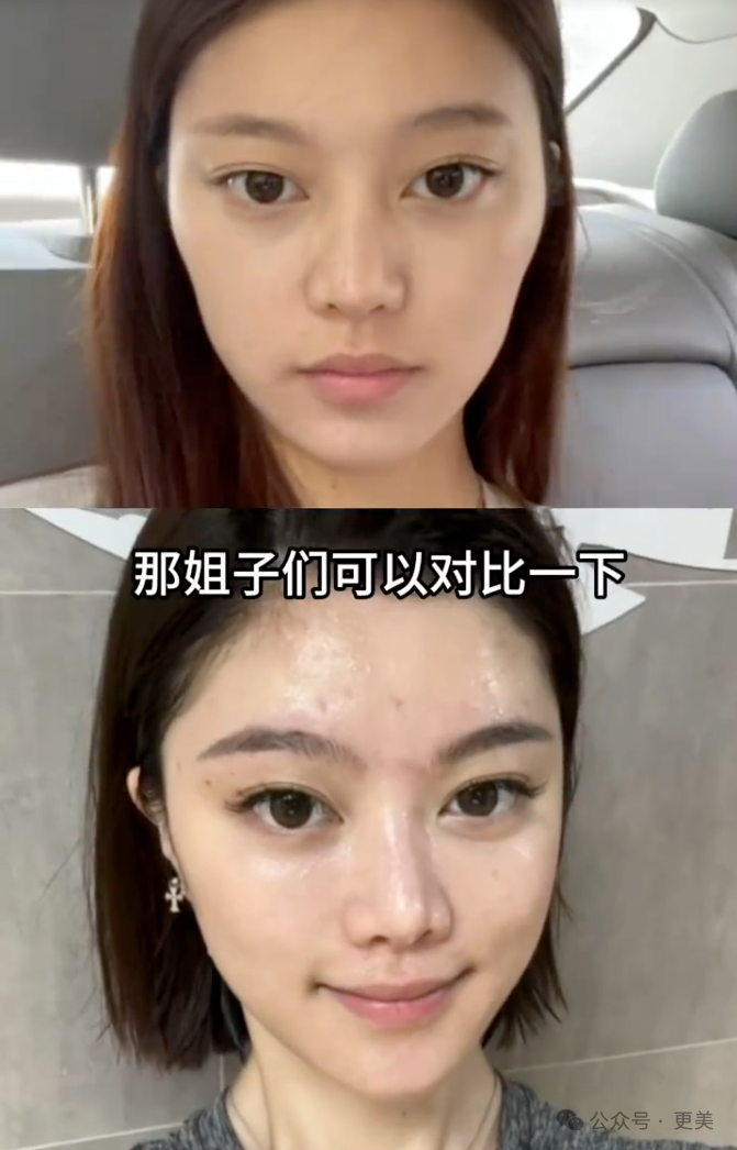 她光鼻子就整了3次!|网红_新浪新闻