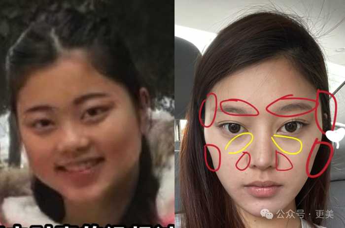 菱形脸网红爆改美成fbb!她光鼻子就整了3次!|网红_新浪新闻