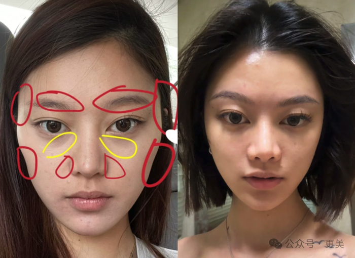 菱形脸网红爆改美成fbb!她光鼻子就整了3次!|网红_新浪新闻