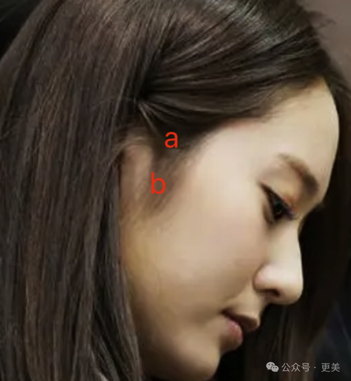 不喜欢下颌角的女生也可以把点位稍稍上移到耳基底.
