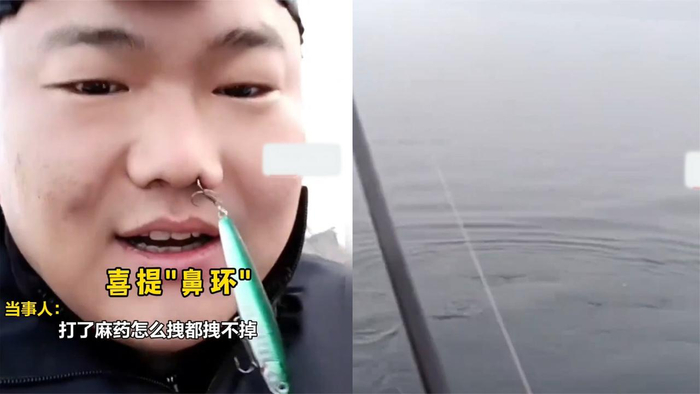 男子生日去河边钓大鱼结果意外将鱼钩勾鼻子上场面心疼又好笑