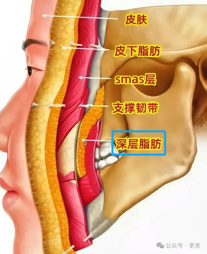 soof,dmcf,颊脂肪垫都属于深层脂肪,肉眼几乎看不到它的移位变化(右.