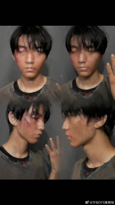 孟超你疼不疼啊