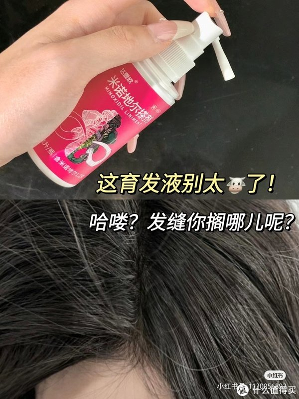 秃头姐妹悠着点用怕你头发飙太快了