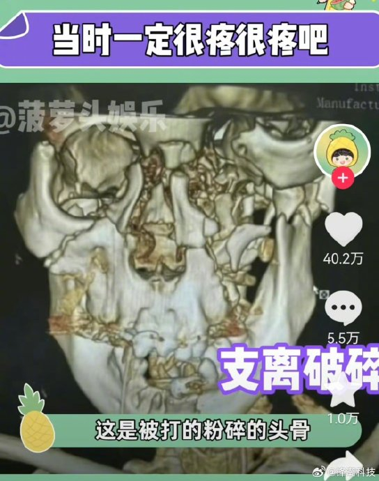 央视辟谣被打粉碎的头骨