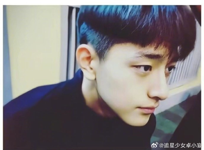 才发现林一以前居然是单眼皮,不仅没丑过,好像也从来没土过