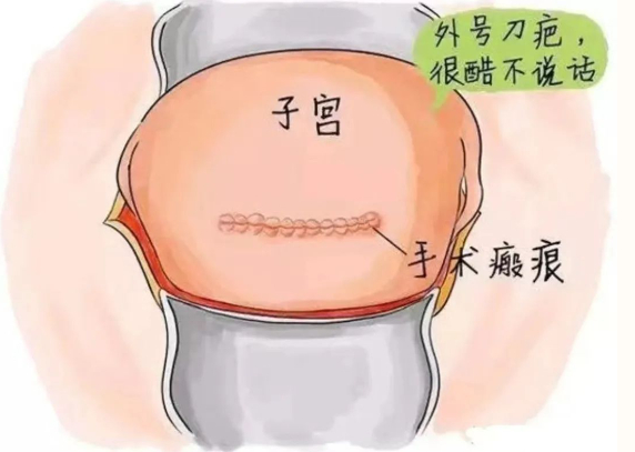 濮阳市人民医院上演生死时速|生死时速|子宫|引产_新浪新闻