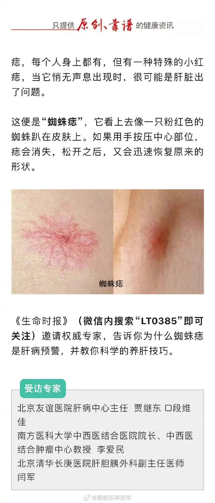 4个部位长红痣可能是肝癌信号|长红|肝癌|部位_新浪新闻