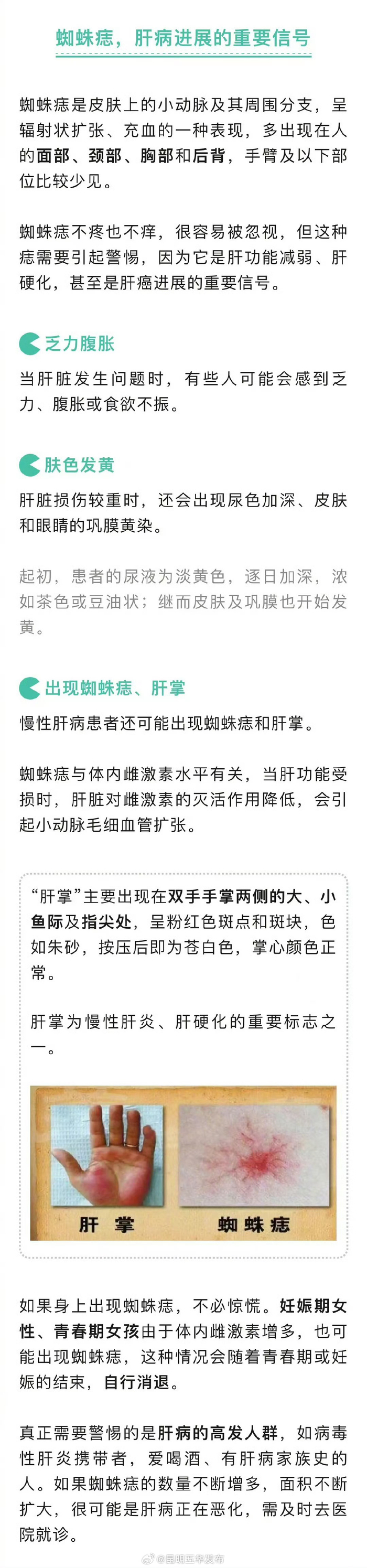 4个部位长红痣可能是肝癌信号|长红|肝癌|部位_新浪新闻