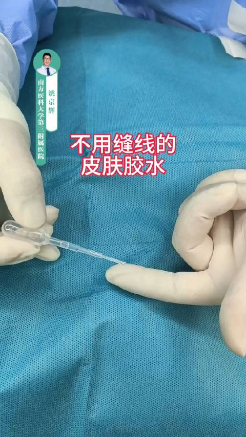 一秒钟粘合的皮肤胶水,无需缝线,伤口没有蜈蚣脚