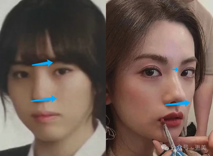 韩素希割双眼皮前,就是典型的韩式肿眼泡啊…|韩素希_新浪新闻