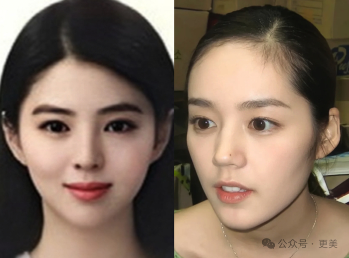 韩素希割双眼皮前就是典型的韩式肿眼泡啊