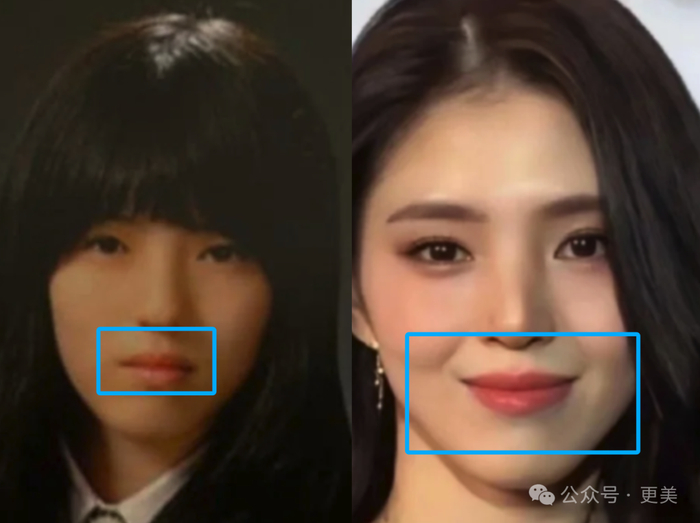 韩素希割双眼皮前就是典型的韩式肿眼泡啊