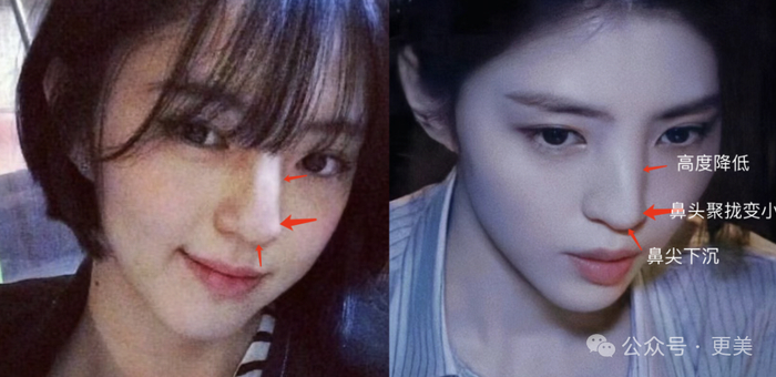 韩素希割双眼皮前,就是典型的韩式肿眼泡啊