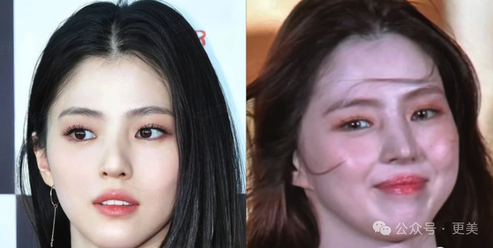 韩素希割双眼皮前就是典型的韩式肿眼泡啊