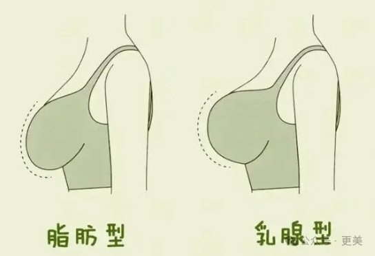 23岁妈妈桑背后金主被抓!名品xiong保住她富贵荣华…|胸部|乳腺|体重_