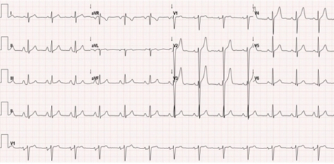图3.心电图较前无显著变化