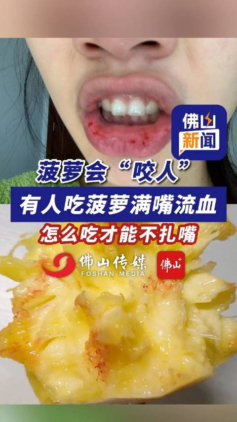 又到了炫菠萝的季节有人吃菠萝吃到满嘴流血怎么吃才能不扎嘴