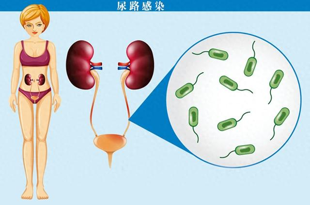 推荐两内服外敷方,快收藏|尿路感染_新浪新闻