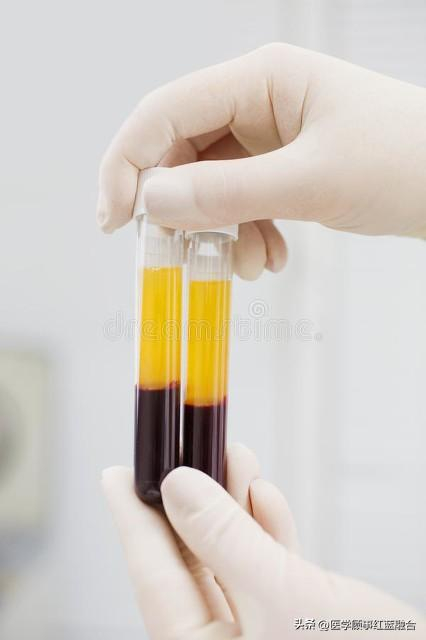 富血小板血浆应用|血小板|因子|肌腱_新浪新闻