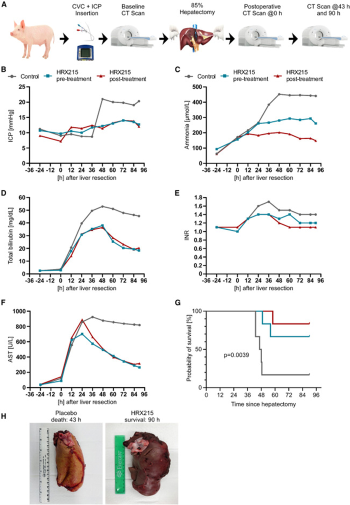 85%肝脏切除时会发生致命的肝切除术后肝衰竭(phlf),然而hrx215手术前
