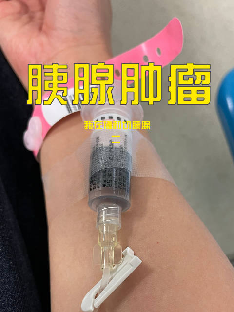 好的,协和胰腺手术2,更新了 其实,我一次就全录完了